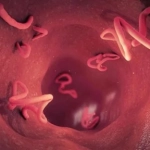 cara mencegah cacing